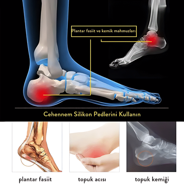 Ortho Flexi-Silikon Epin Topukluk - Görsel 6