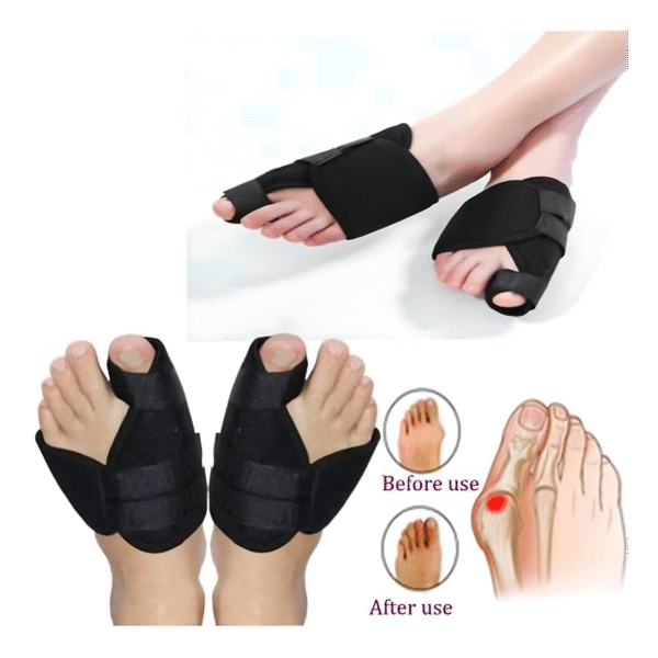 Ortho Flexi-Hallux Valgus Gece Ateli - Görsel 3